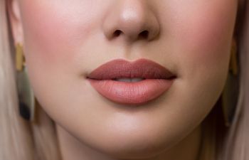 Achieve Your Best Pout with Our Signature Cupid Lift™ Procedure