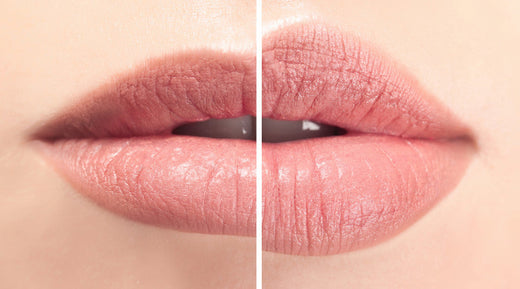 Rejuvenate Your Appearance with Neuromodulator Facial Treatments at Cupid Lips®