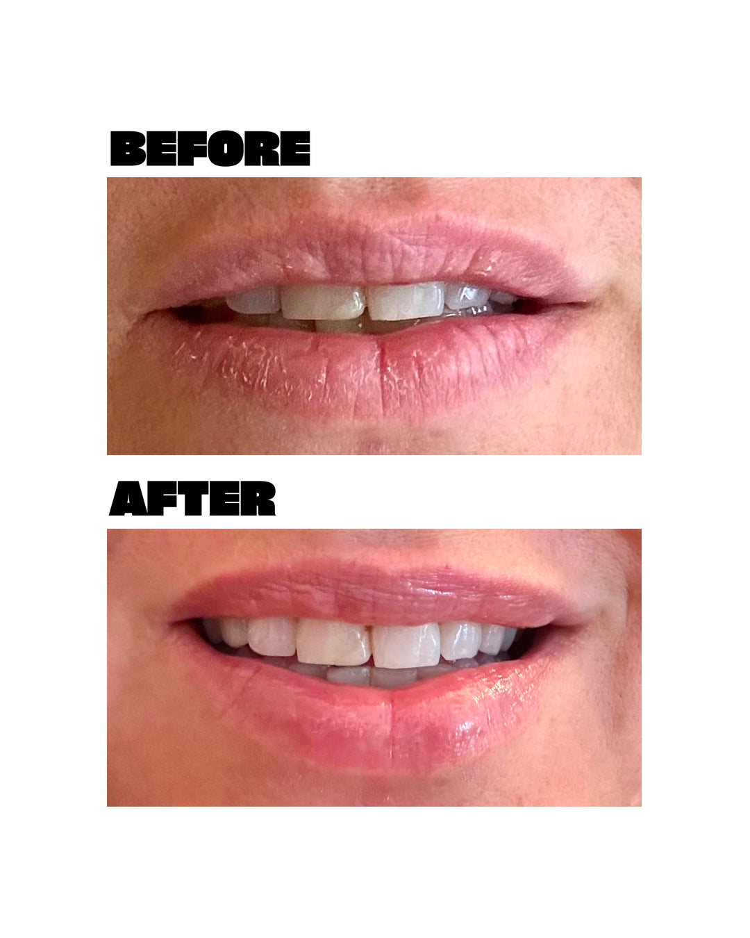 Babe Original Lip Mask