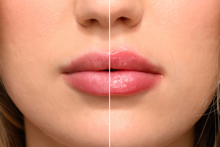 The Lip Plumper