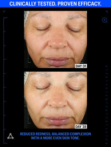 Copper Tripeptide & Ectoin Advanced Repair Serum