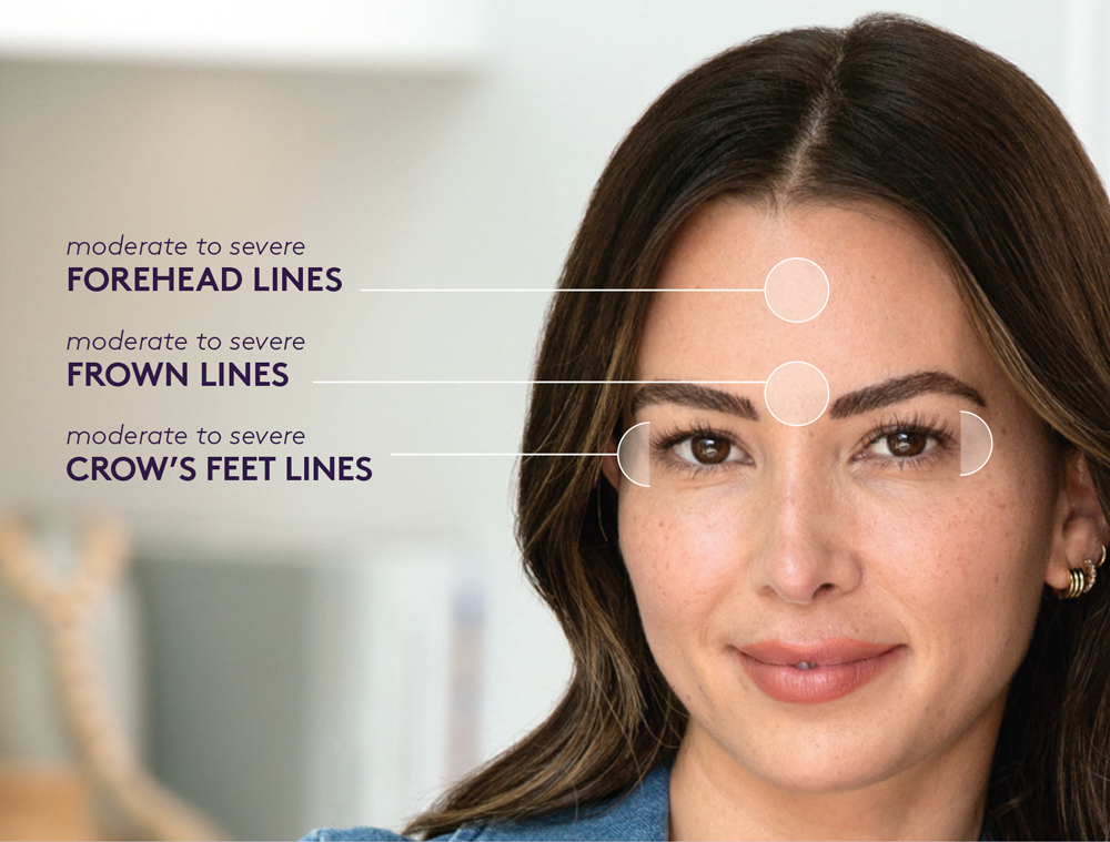 Los Angeles Botox®/Dysport® Injections | West Hollywood Neurotoxin Lip ...