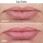 PMD Kiss Lip Plumping Device