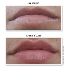 DefenAge 12-Factor Revitalizing Lip Enhancer,