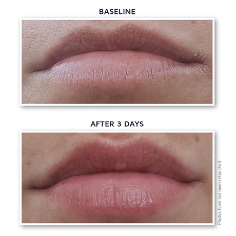 DefenAge 12-Factor Revitalizing Lip Enhancer,