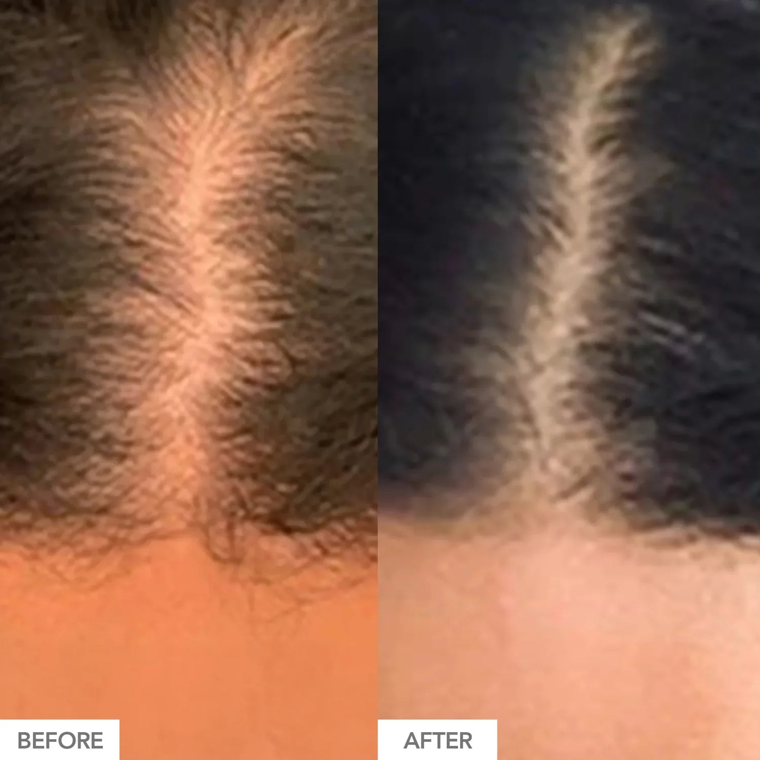 HAIRtamin® Mom Formula