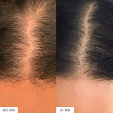 HAIRtamin® Mom Formula